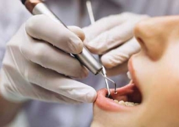 جرمگیری به دندان آسیب می زند؟