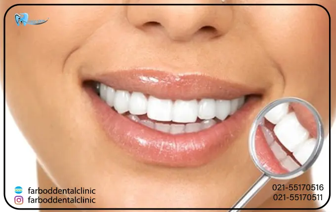 6 مرحله انجام کامپوزیت دندان به روش لیرینگ