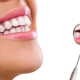 باندینگ دندان در کلینیک دندانپزشکی فربد