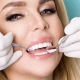 کاربردها و معایب انواع کامپوزیت دندان