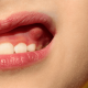 دلایل آبسه دندان کودکان