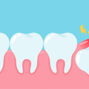 علت درآمدن دندان عقل