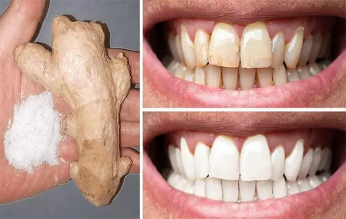 چرا رنگ دندان ها تغییر می دهند؟
