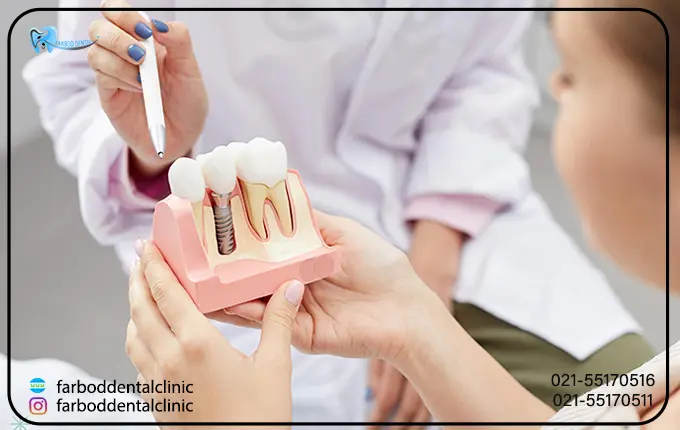 چرا مراقبت از ایمپلنت های دندانی مهم است؟
